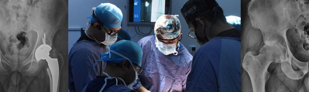 Header abordajeviaanterior